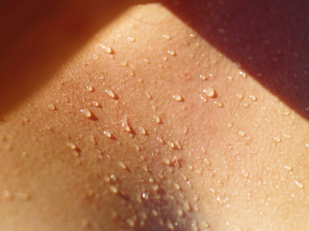 sweaty skin