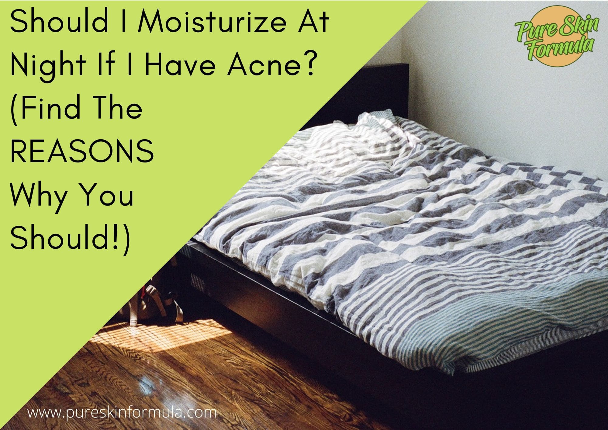 Should I Moisturize At Night If I Have Acne_featured image-