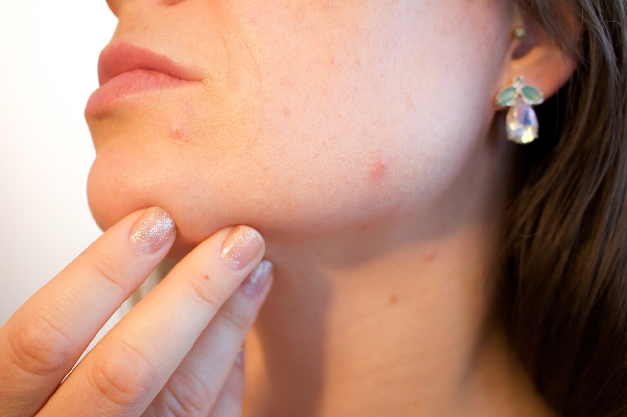 a woman watching pimples on her face