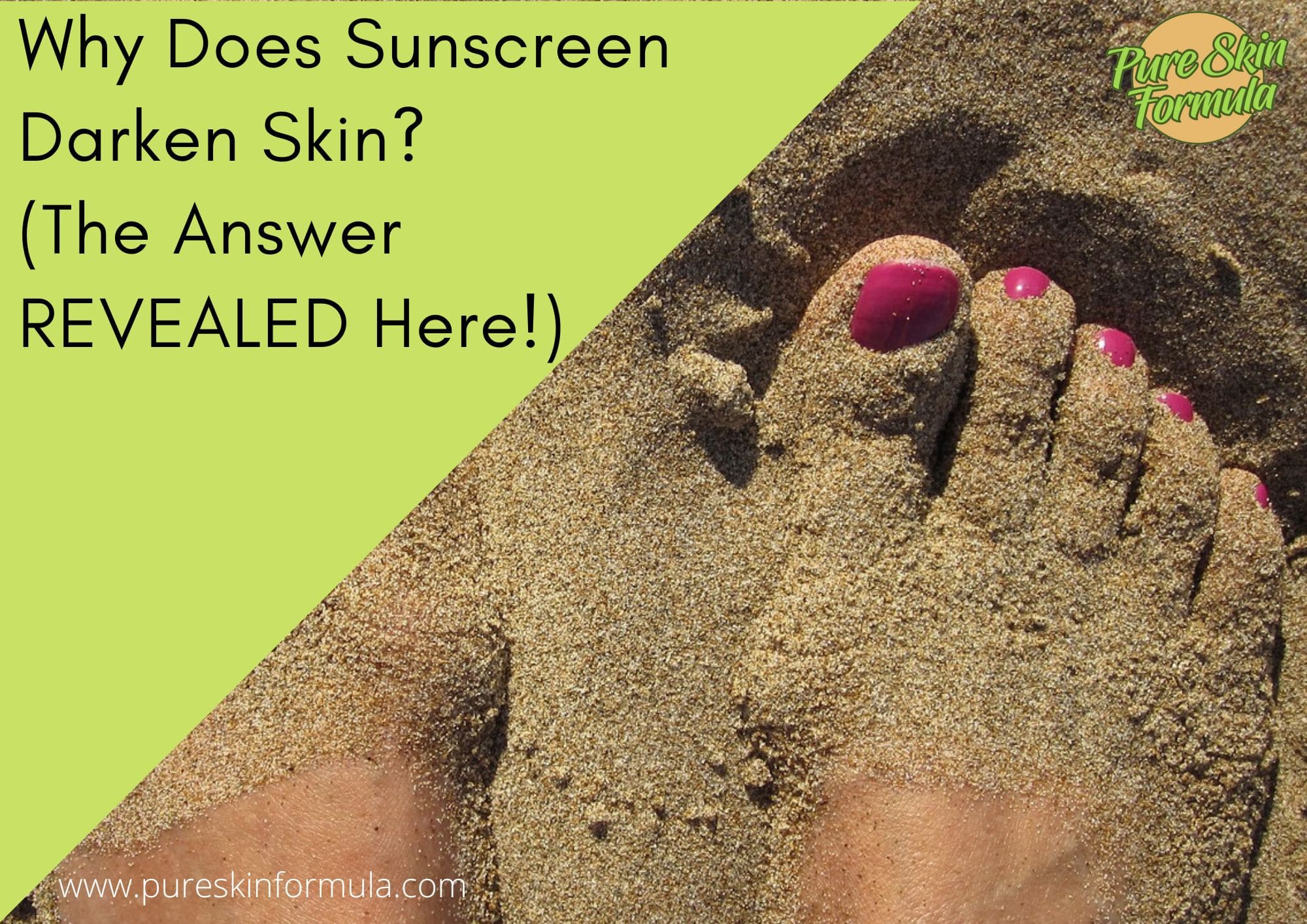 Why Does Sunscreen Darken Skin_featured image